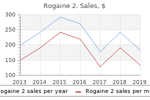 buy rogaine 2 60ml free shipping