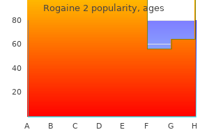 order 60ml rogaine 2